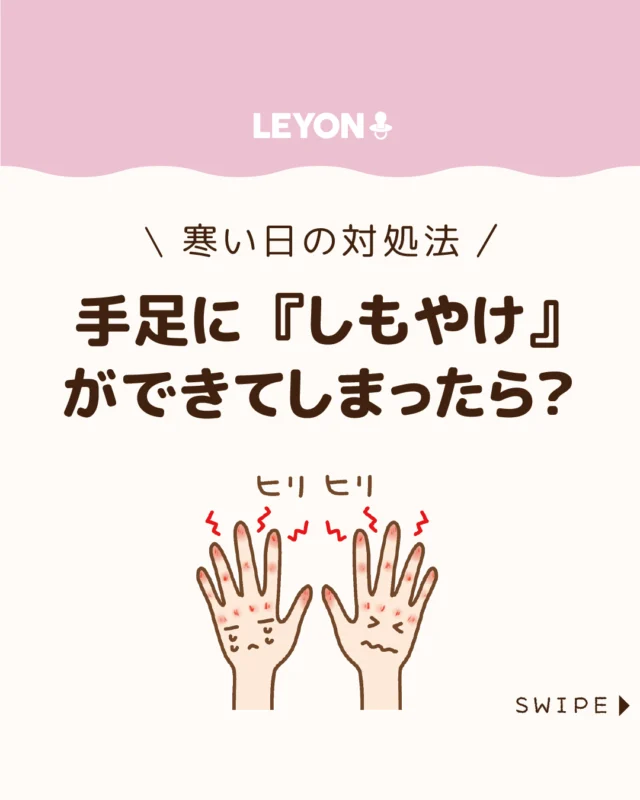 【子どもの『しもやけ』どうしたらいい？】

寒い季節に子どもの手足が赤く
腫れてかゆみや痛みを伴う「しもやけ」✋👣💦

寒暖差による血行不良が主な原因で、
放っておくと水ぶくれやただれに
進むこともあるため、早めに原因を理解し、
予防・対処してあげることが大切です。

今回は、子どもの冷えの原因や
対策についてご紹介します。

ぜひ参考にしてみてくださいね👶🏻👧🏻👦🏻💕
.
.
꧁————————————————꧂

LEYON公式インスタグラムでは
アイテムやお得情報・子育てについてのコラムを更新中！

check!▷▶@leyon.official
プロフィールから商品詳細ページが確認できます👆

気になる投稿は保存で後からチェック✅
フォロー・いいねお待ちしております💕
꧁————————————————꧂

#子どものしもやけ #しもやけ #しもやけ対策 
#暮らし #子どものいる生活 #育児 #育児中 #育児奮闘中 #育児ママ #育児パパ #育児の悩み #育児を楽しむ #育児グッズ #ベビーグッズ #子どもご飯 #レシピ #子どもの栄養 #野菜不足 #食物繊維 #新型栄養欠乏 #鉄分不足 #鉄分補給 #離乳食 #幼児食 #栄養満点 #タンパク質 #ブレインフード