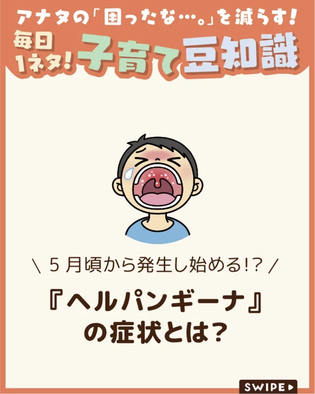 【『ヘルパンギーナ』の症状とは？】

ヘルパンギーナは、
夏に流行しやすいウイルス感染症で、
特に乳幼児や子どもに多く見られます😱

5月頃から増え始め、
6〜7月にピークを迎えるのが特徴。
では、どんな症状があらわれるのでしょうか？🤔

今回は、ヘルパンギーナの症状や原因、
治療・予防法、登園・登校の目安
について解説します。

ぜひ参考にしてみてくださいね👶🏻👧🏻👦🏻💕
.
.
꧁————————————————꧂

LEYON公式インスタグラムでは
アイテムやお得情報・子育てについてのコラムを更新中！

check!▷▶@leyon.official
プロフィールから商品詳細ページが確認できます👆

気になる投稿は保存で後からチェック✅
フォロー・いいねお待ちしております💕
꧁————————————————꧂

#ヘルパンギーナ #ヘルパンギーナの症状 #ヘルパンギーナの予防法
#暮らし #子どものいる生活 #育児 #育児中 #育児奮闘中 #育児ママ #育児パパ #育児の悩み #育児を楽しむ #育児グッズ #ベビーグッズ #子どもご飯 #レシピ #子どもの栄養 #野菜不足 #食物繊維 #新型栄養欠乏 #鉄分不足 #鉄分補給 #離乳食 #幼児食 #栄養満点 #タンパク質 #ブレインフード