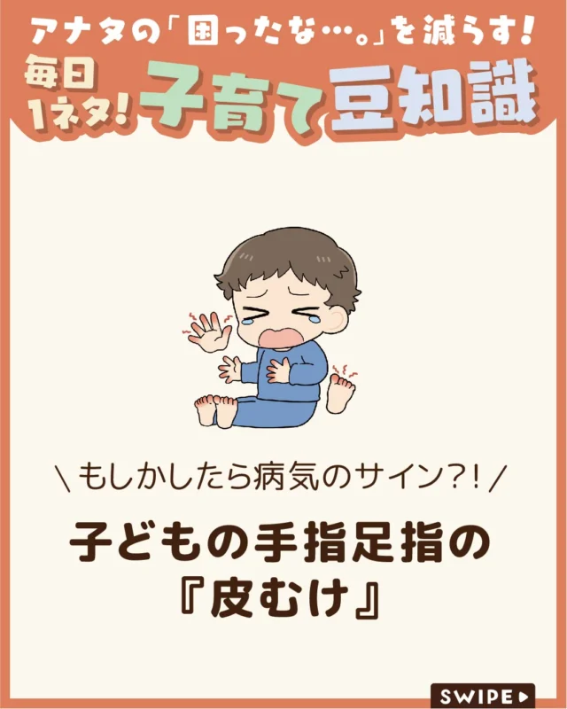 【子どもの手指足指の『皮むけ』】

お子さんの指先や足の裏の皮むけに
気づくと、「病気では？」と心配になりますよね😰

子どもの皮膚はデリケートなため、
乾燥や刺激、さまざまな皮膚トラブルによって
皮がむけることがあります😲

今回は、子どもの手足の皮むけの
主な原因や家庭でのケアついて解説します。

ぜひ参考にしてみてくださいね👶🏻👧🏻👦🏻💕
.
.
꧁————————————————꧂

LEYON公式インスタグラムでは
アイテムやお得情報・子育てについてのコラムを更新中！

check!▷▶@leyon.official
プロフィールから商品詳細ページが確認できます👆

気になる投稿は保存で後からチェック✅
フォロー・いいねお待ちしております💕
꧁————————————————꧂

#子どもの皮むけ #手指の皮むけ #足指の皮むけ
#暮らし #子どものいる生活 #育児 #育児中 #育児奮闘中 #育児ママ #育児パパ #育児の悩み #育児を楽しむ #育児グッズ #ベビーグッズ #子どもご飯 #レシピ #子どもの栄養 #野菜不足 #食物繊維 #新型栄養欠乏 #鉄分不足 #鉄分補給 #離乳食 #幼児食 #栄養満点 #タンパク質 #ブレインフード